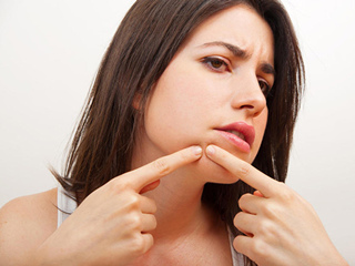 痘痘怎么快速消除 以下消痘大招没几个人知道错过可惜