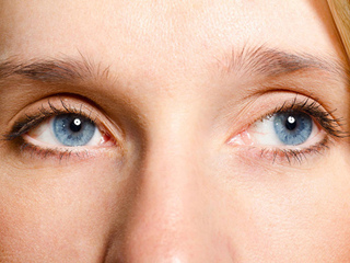 眼角两边长斑怎么办 淡化掉眼角斑点还原漂亮双眸