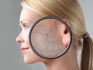 激素脸干怎么补水 5步修复补水告别激素沙漠肌