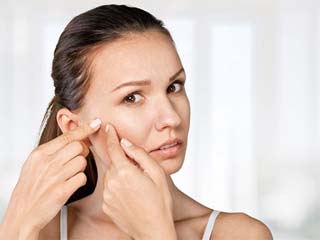 痘痘挤出来的白色东西是什么 戳进来小编带你涨姿势