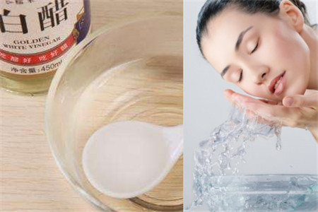 史上最全面的白醋洗脸有什么好处
