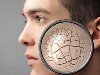 祛痘印的面膜品牌 2017年度最好用的去痘印美白面膜排行榜