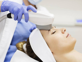 激光祛斑后会不会反弹 只要跟斑点类型和护肤方法有关哦