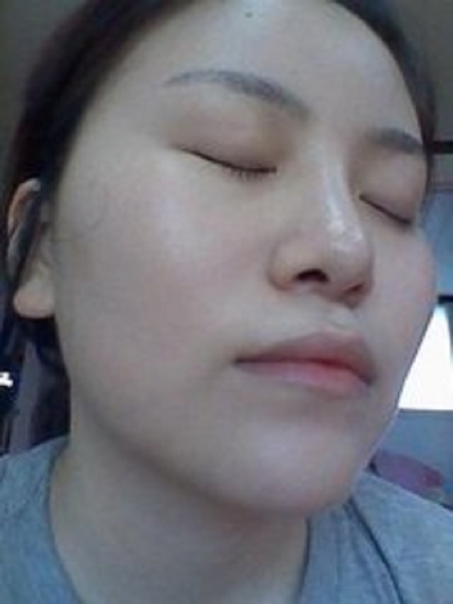 假体植入满足那些年你未完成的遗憾和不满。