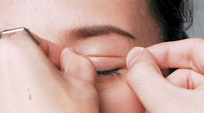 想拥有一双美丽的大眼睛吗？了解做双眼皮多少钱