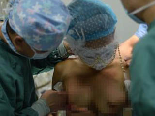 嫩模直播丰胸手术 全裸播放从扁平A罩杯到波涛汹涌过程