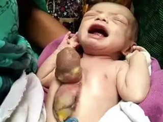 新生女婴心脏长胸外 全家陷入崩溃背后的真相令人震惊