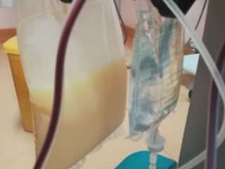 体内抽出牛奶血 不良饮食习惯竟出现白色液体血液