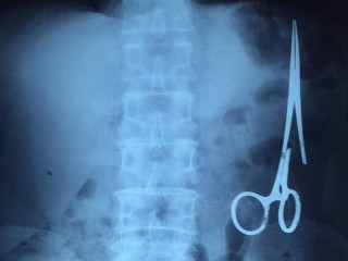 剪刀遗留腹中18年 揭剪刀遗留腹中真相令人唏嘘不已