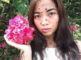 女子全身长满斑点 真人照片曝光很恐怖却满怀信心成环球小姐