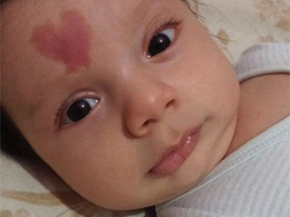 男孩额头长心形胎记 “爱之子”天生异相萌化万千网友心