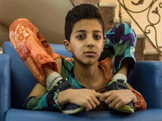 少年全身365度折叠 身体极度柔韧堪比“无骨人”令人称奇