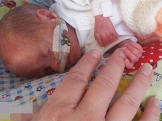 出生仅九两的婴儿奇迹存活 曾被医生断言无法存活下来