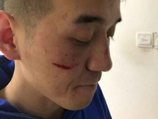 蛋蛋解说回应被打 贝拉啦喝多认错人回应炒作质疑