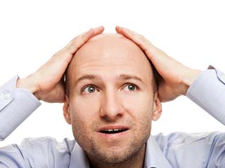 男性脱发的原因 自作自受男性青年面临秃顶危机