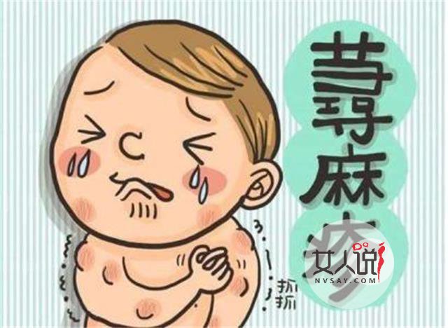 荨麻疹图片，做好心理准备再看哦！
