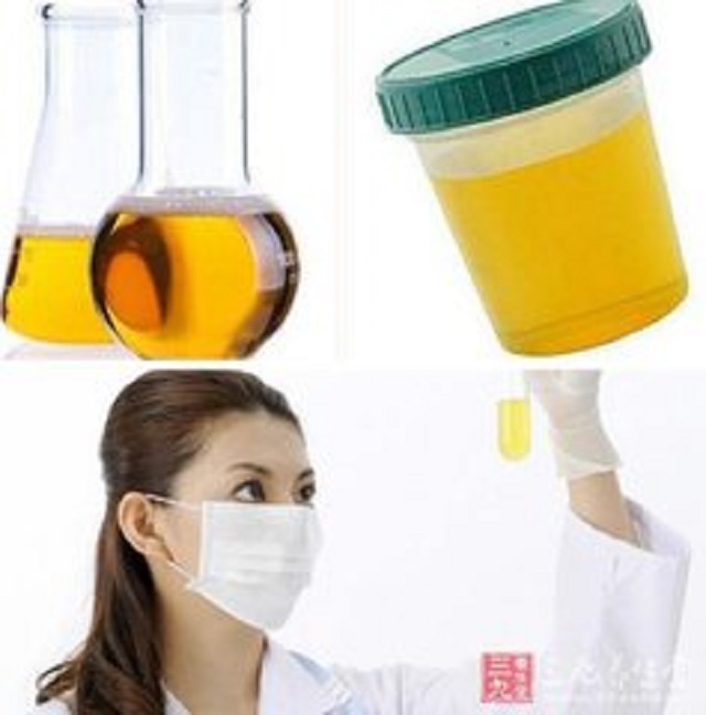 小便有泡沫？竟是你的身体可能出了哪些问题？不能忽视！！！