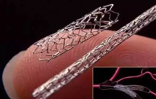 知道心脏支架是什么吗？心脏支架适应症和费用