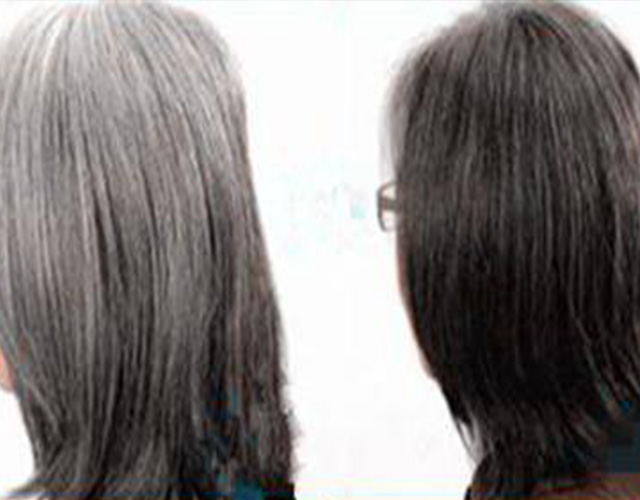 生活小妙招：白发变黑发的方法大盘点