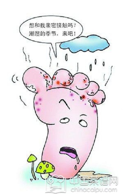 脚气怎么治？对症下药很关键！